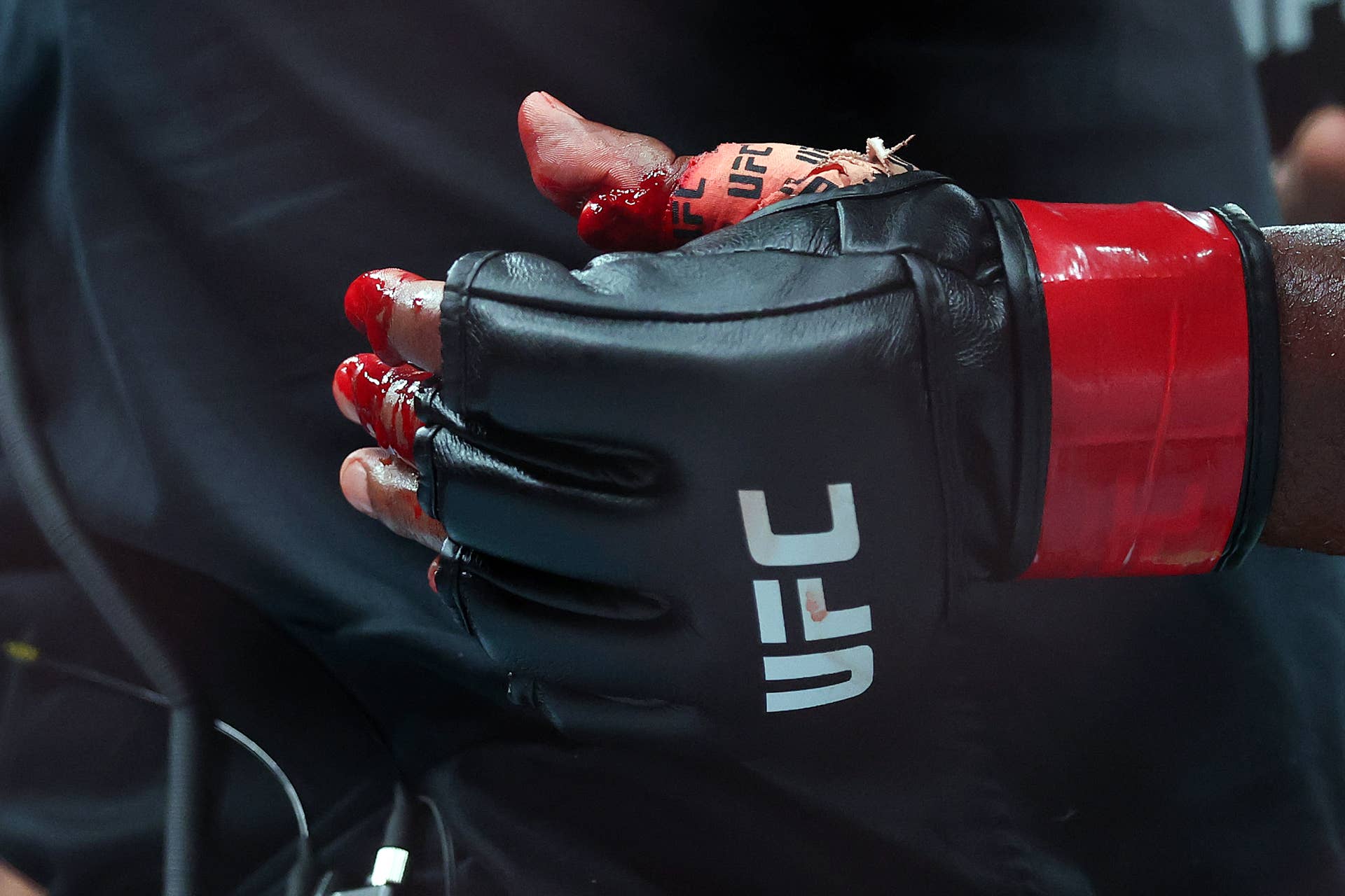 Alonzo Menifield's Thumb Bone Stuck Out During UFC 331 Fight - Athlon