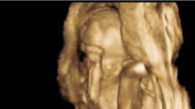 tebowing-baby-ultrasound-cropped.jpg