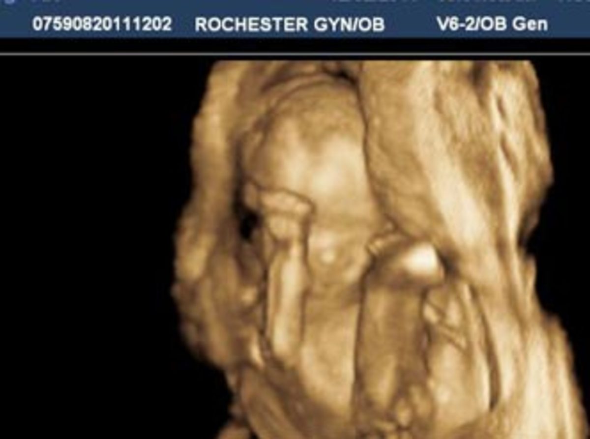 tebowing-baby-ultrasound-cropped.jpg