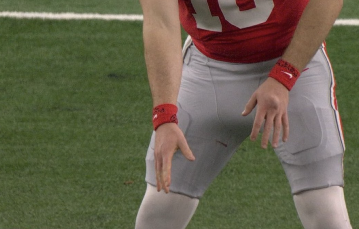 Fans Grossed Out by Image of Will Howard's Hand Injury in Cotton Bowl